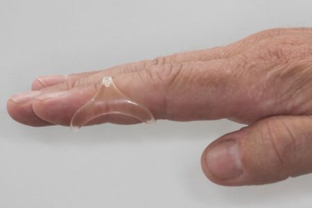 mallet finger splint