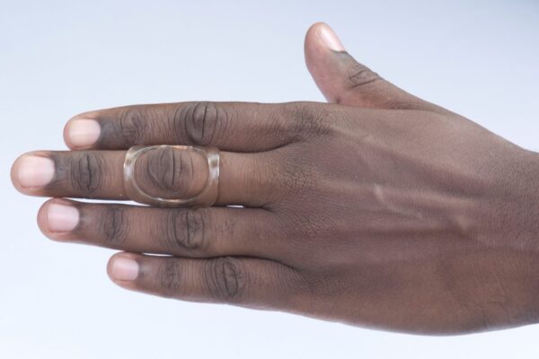 1HM hypermobility finger splint