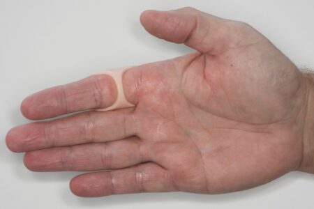 swan neck finger splint