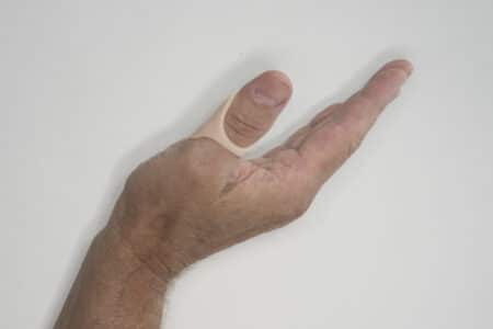 thumb arthritis splint