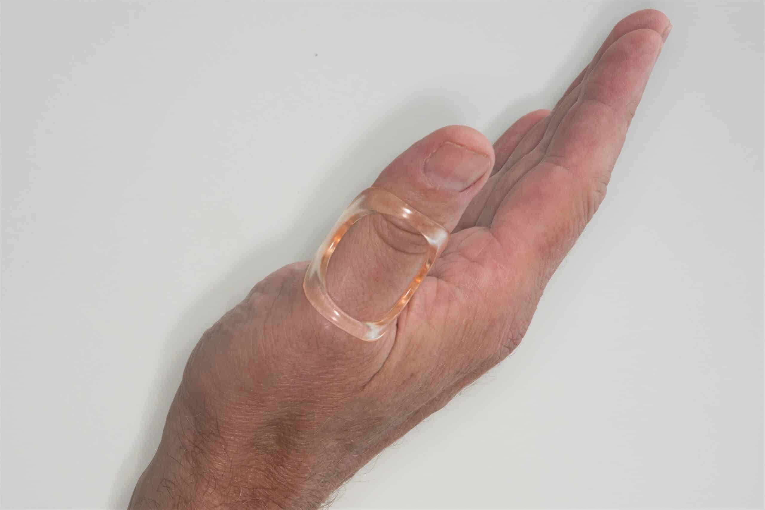 thumb hypermobility splint (EDS)